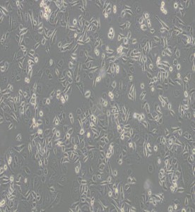 AGS人胃腺癌細(xì)胞主圖