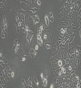 BIU-87人膀胱癌細胞主圖