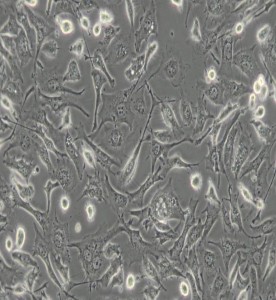 BT-549人乳腺管癌細胞主圖