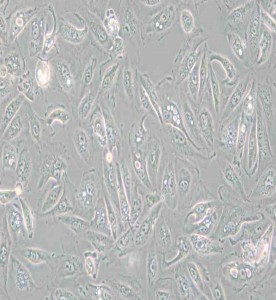Caki-1人腎透明細(xì)胞癌皮膚轉(zhuǎn)移細(xì)胞主圖