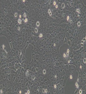 CAL-27人舌鱗癌細胞主圖