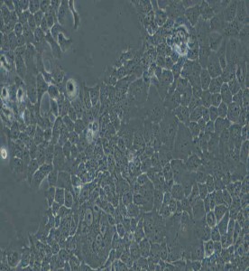 FaDu人咽鱗癌細(xì)胞主圖