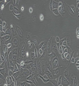 GBC-SD人膽囊癌細(xì)胞主圖