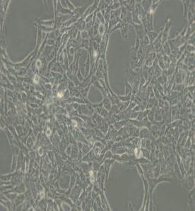 HBL-100人整合SV40基因的乳腺上皮細(xì)胞主圖