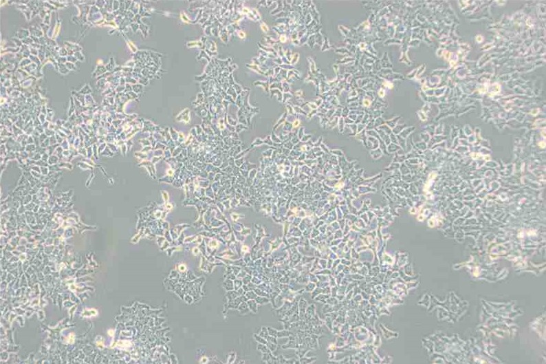 H-4-II-E 大鼠肝細胞瘤主圖