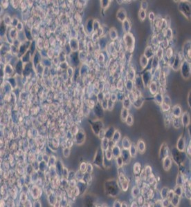 Y3-Ag 1.2.3大鼠骨髓瘤細(xì)胞主圖