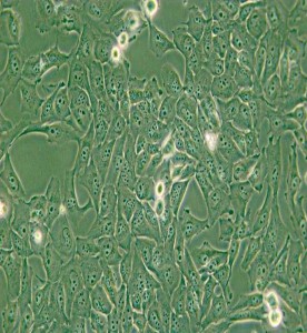 KMH-2人甲狀腺癌細(xì)胞主圖