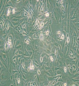 KTC-1人甲狀腺癌細(xì)胞主圖