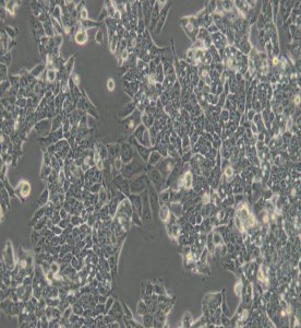 LoVo人結(jié)腸癌細胞主圖