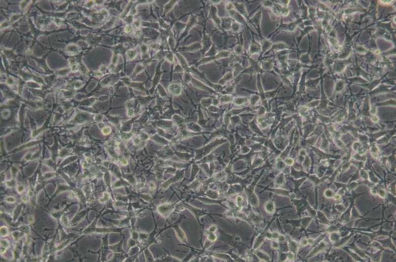 K7M2-WT小鼠骨肉瘤成骨細(xì)胞主圖