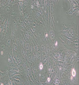 LX-2人肝星形細胞主圖
