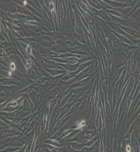 MG-63人骨肉瘤細(xì)胞主圖