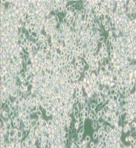 MIA PaCa-2人胰腺癌細(xì)胞主圖