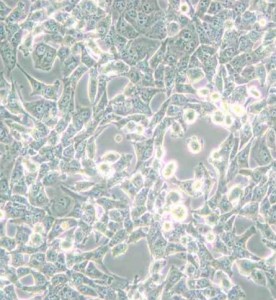 95-D[PLA-801D]人高轉(zhuǎn)移肺癌細(xì)胞主圖