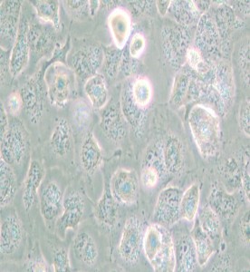 NCI-H661人大細(xì)胞肺癌細(xì)胞主圖
