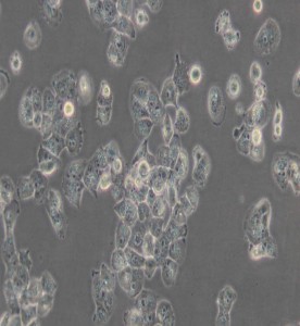 NCI-H1299人非小細(xì)胞肺癌細(xì)胞主圖