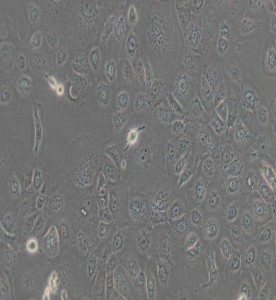 NCI-H1650人非小細(xì)胞肺癌細(xì)胞主圖