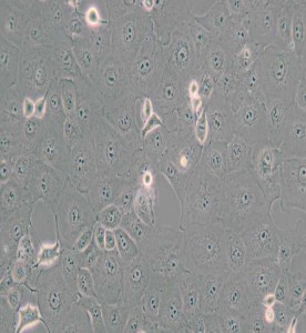 MARC-145非洲綠猴胚胎腎細(xì)胞主圖