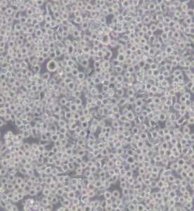 6T-CEM人T細(xì)胞白血病細(xì)胞主圖