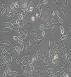 PC-3M人前列腺癌細(xì)胞主圖