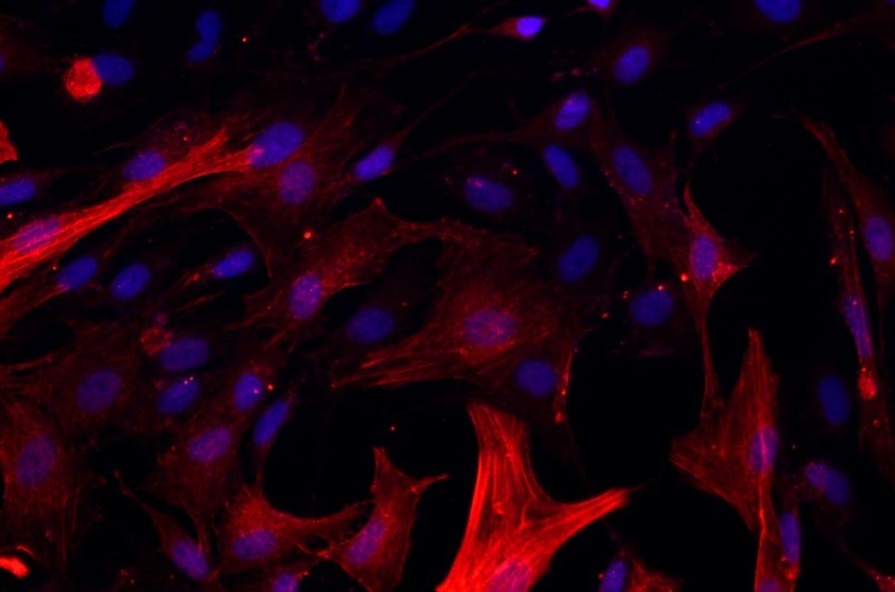 大鼠氣管平滑肌細(xì)胞主圖