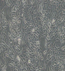 RKO人結(jié)腸腺癌細(xì)胞主圖