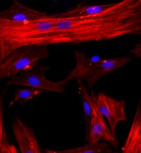 大鼠肝星狀細(xì)胞主圖