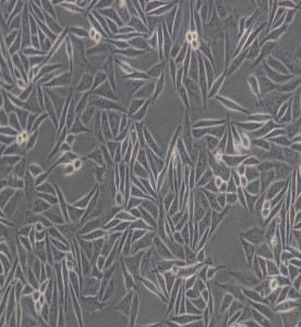 SiHa人子宮頸鱗癌細(xì)胞主圖