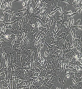 SK-HEP-1人肝癌細(xì)胞主圖