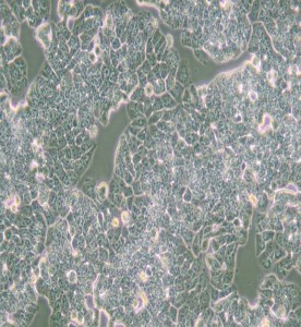 T-47D人乳腺管癌細(xì)胞主圖