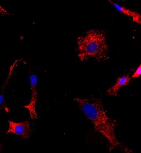 大鼠關節(jié)軟骨細胞主圖