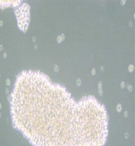 MT-4人T細(xì)胞白血病細(xì)胞主圖