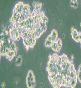 NCI-H209 [H209]人小細(xì)胞肺癌細(xì)胞主圖