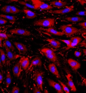 大鼠心臟微血管內(nèi)皮細胞主圖