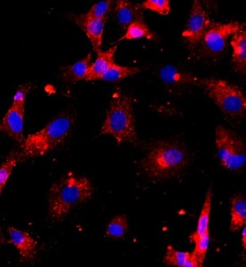 大鼠椎間盤髓核細(xì)胞主圖