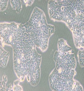 NCI-H1944人肺癌細(xì)胞主圖
