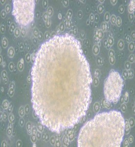 NK-92人惡性非霍奇金淋巴瘤患者的自然殺傷細(xì)胞主圖