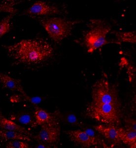 大鼠椎間盤纖維環(huán)細胞主圖