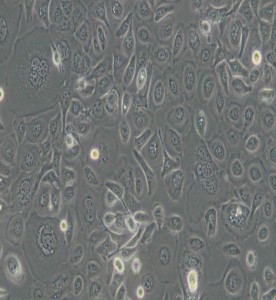 TE-1人食管癌細(xì)胞主圖