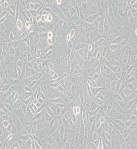 TPC-1人甲狀腺癌細(xì)胞主圖