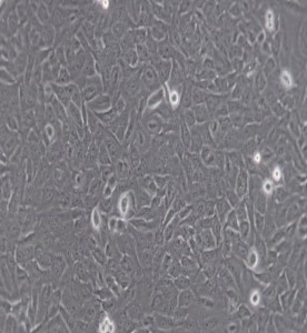 U-2OS人骨肉瘤細(xì)胞主圖