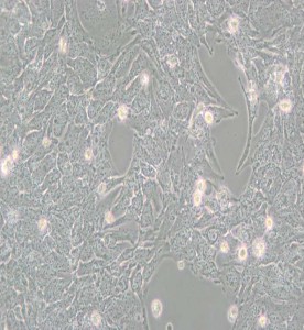 TTA1人甲狀腺癌細胞主圖