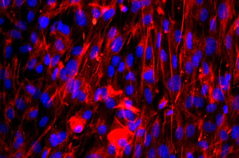 小鼠肺成纖維細(xì)胞主圖