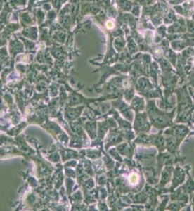 2V6.11人胚腎細(xì)胞主圖