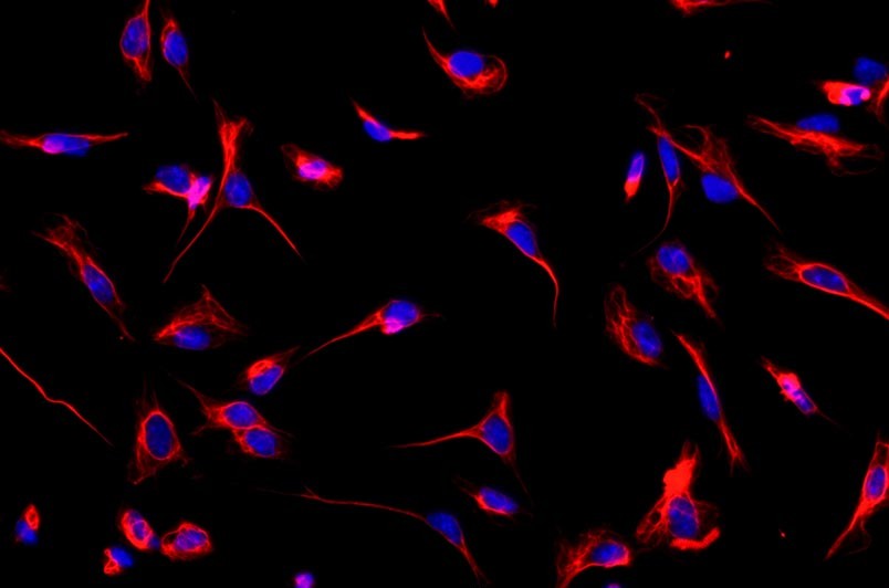 小鼠心肌成纖維細(xì)胞主圖
