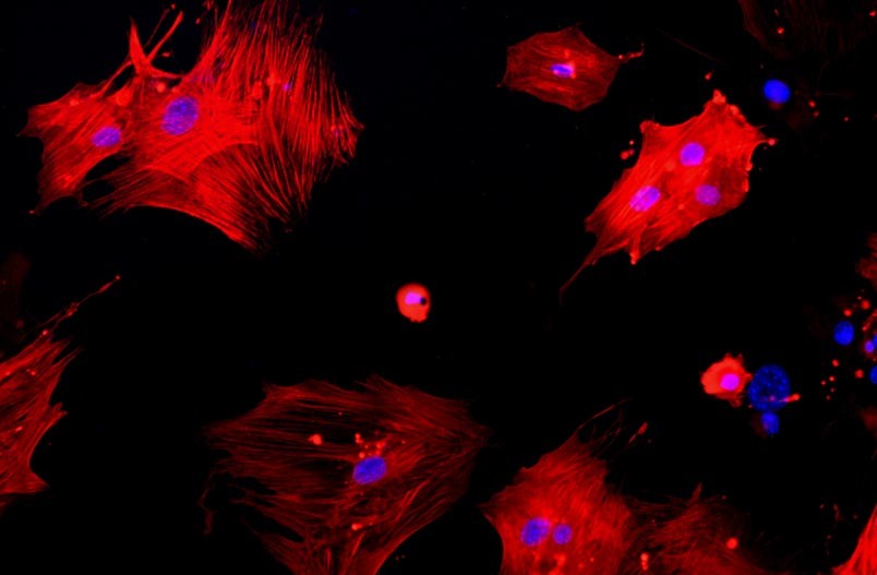 小鼠主動(dòng)脈平滑肌細(xì)胞主圖