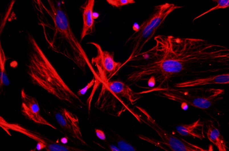 小鼠真皮成纖維細(xì)胞主圖