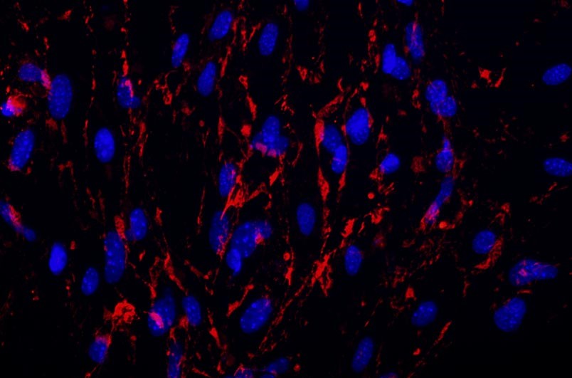 小鼠腦微血管內(nèi)皮細(xì)胞主圖
