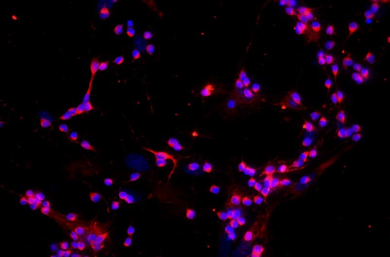 小鼠視網(wǎng)膜神經(jīng)節(jié)細(xì)胞主圖