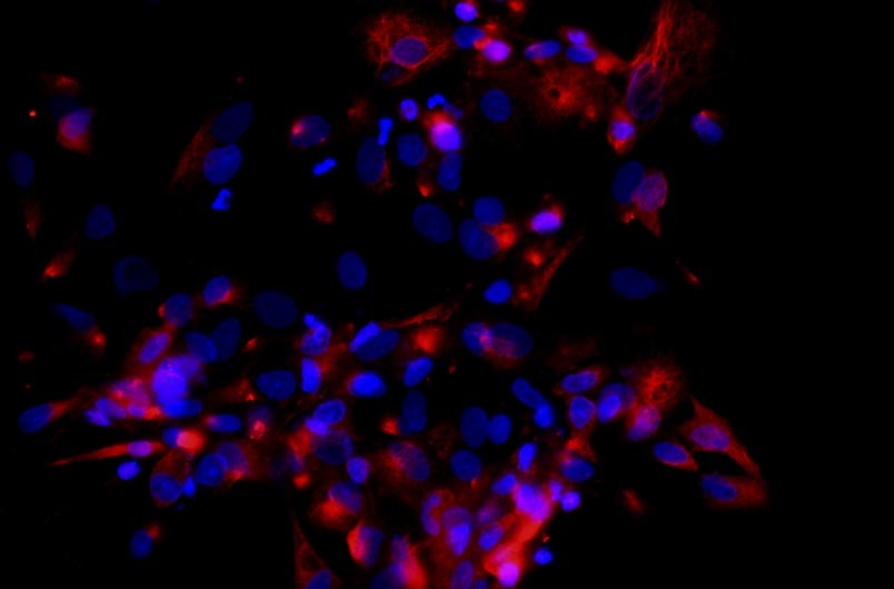 小鼠肝外膽管上皮細(xì)胞主圖